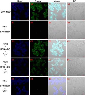 Simultaneous Discrimination of Cys/Hcy and GSH With Simple Fluorescent Probe Under a Single-Wavelength Excitation and its Application in Living Cells, Tumor Tissues, and Zebrafish